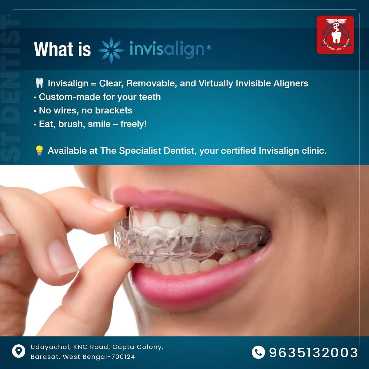 Straight Teeth Without Braces: How Aligners Work? | Clear Aligners ...