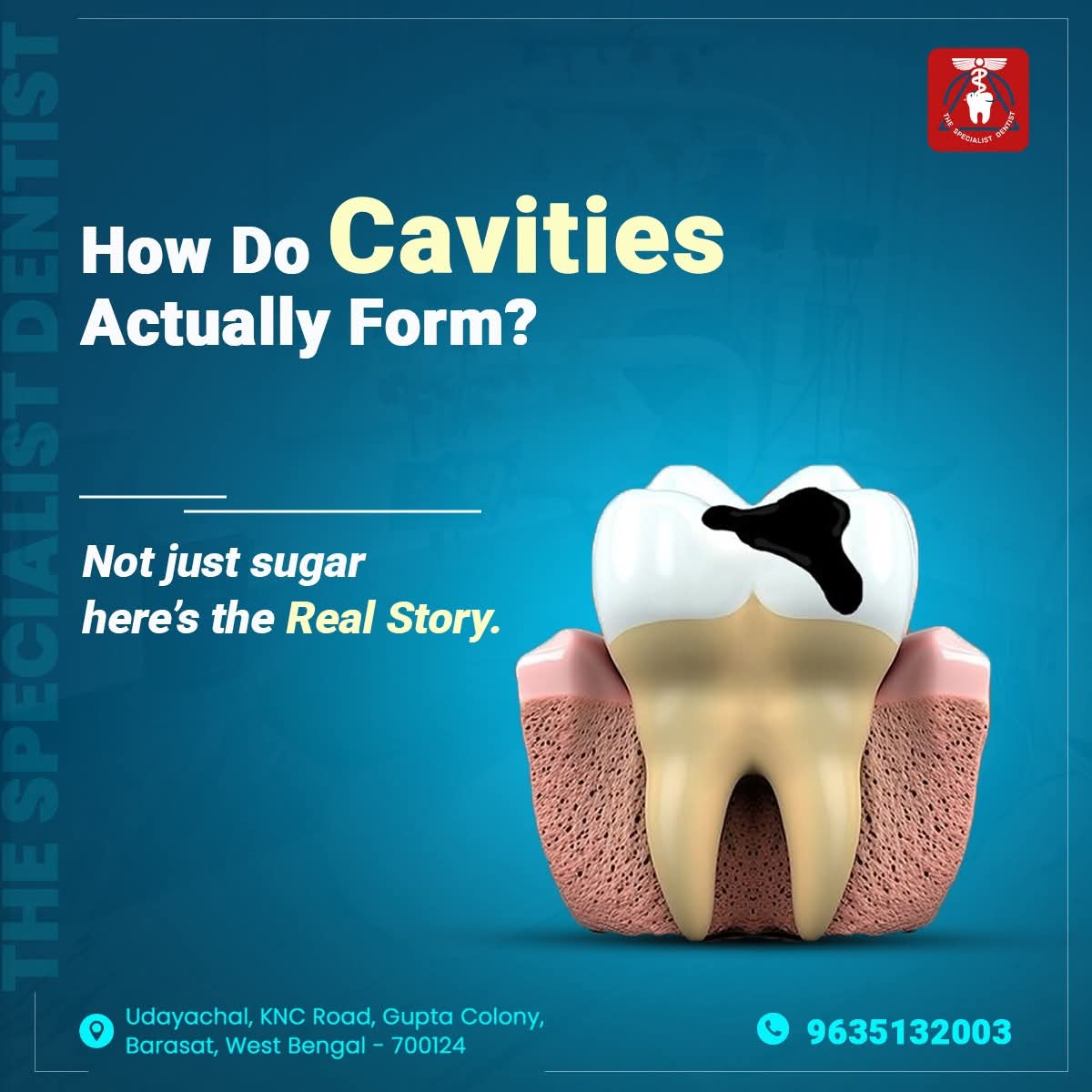 The Truth About Cavities: Common Myths Busted - The Specialist Dentist